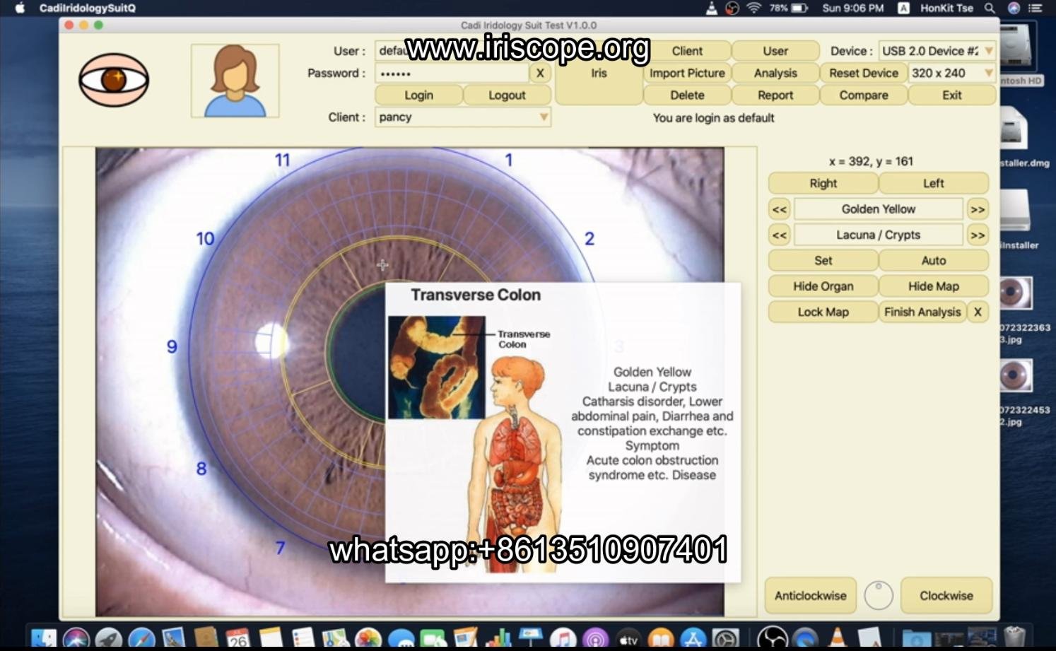 How to use maikong iridology software in apple mac os