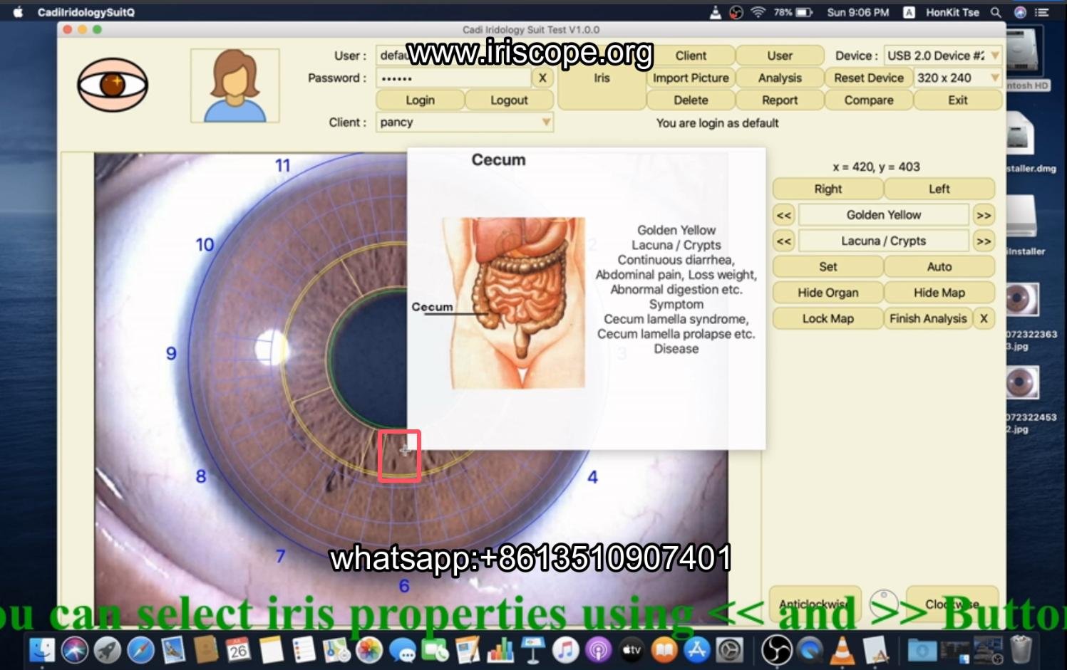 How to use maikong iridology software in apple mac os