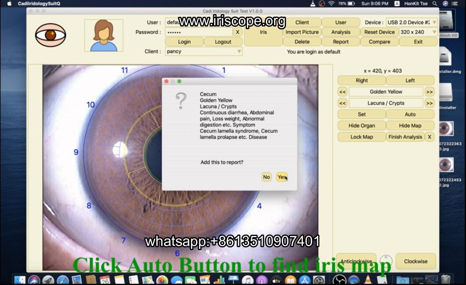How to use maikong iridology software in apple mac os