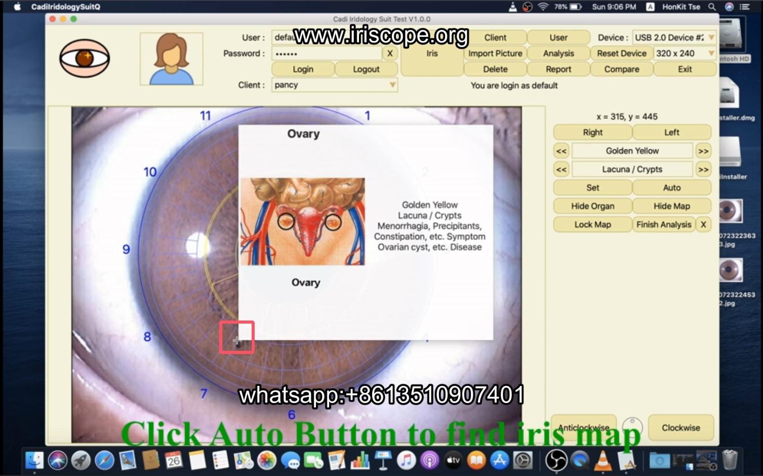 How to use maikong iridology software in apple mac os
