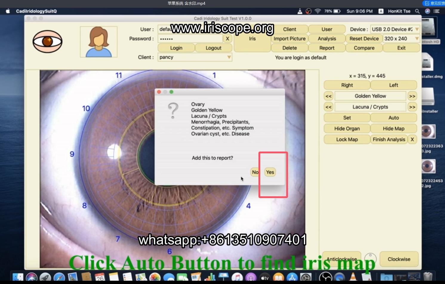 How to use maikong iridology software in apple mac os