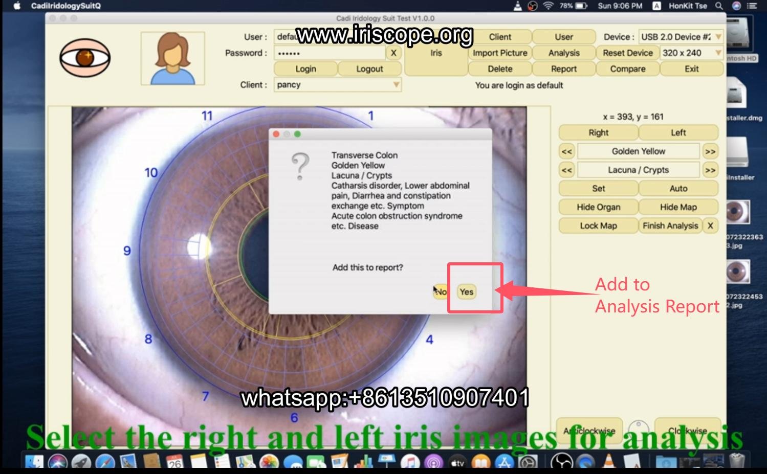 How to use maikong iridology software in apple mac os