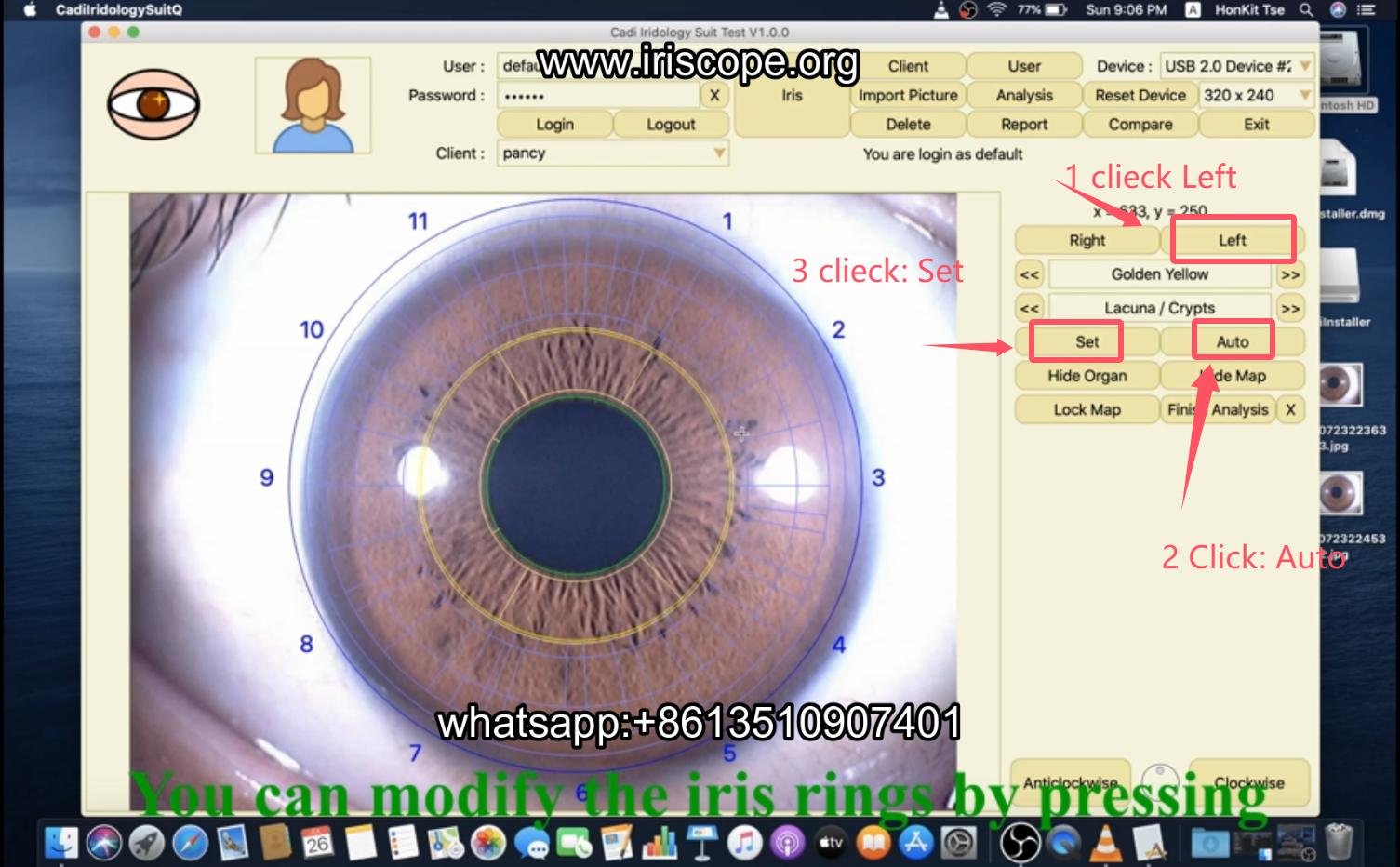 How to use maikong iridology software in apple mac os