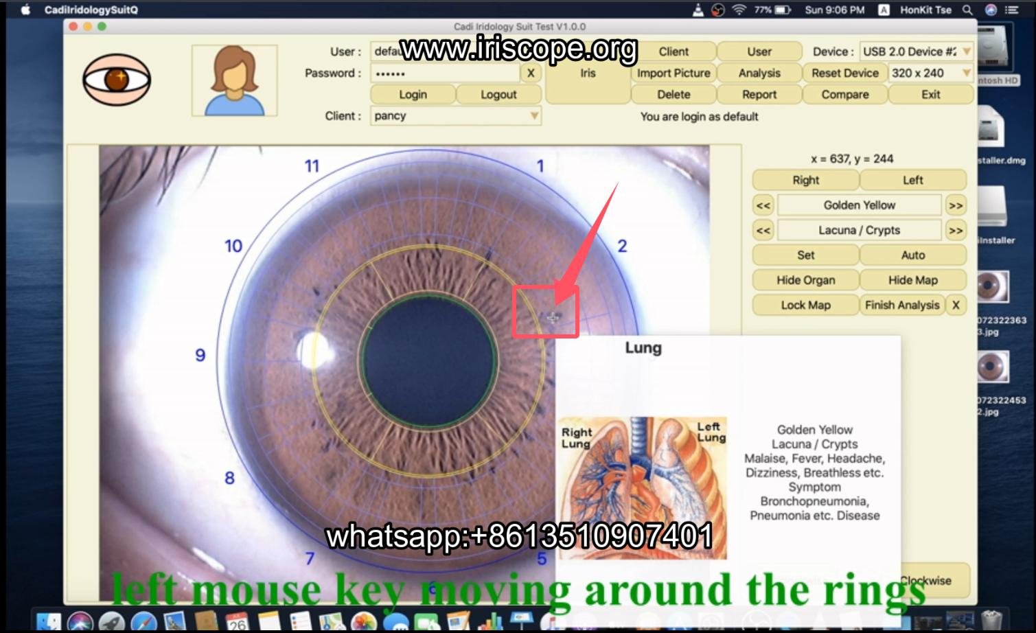 How to use maikong iridology software in apple mac os