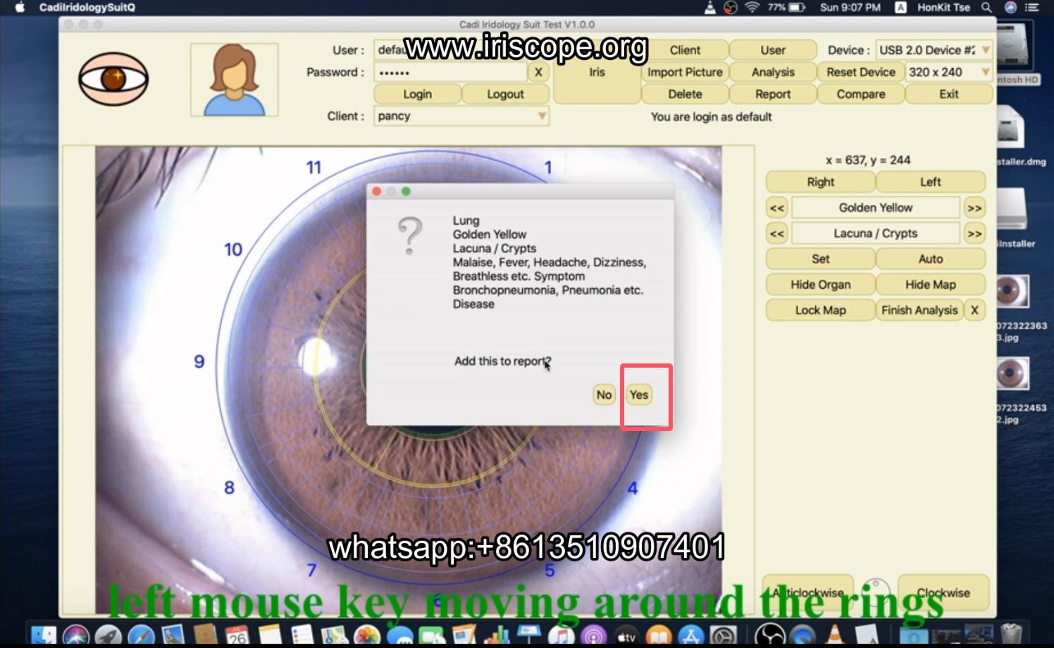 How to use maikong iridology software in apple mac os