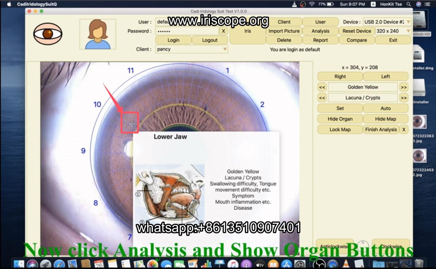 How to use maikong iridology software in apple mac os