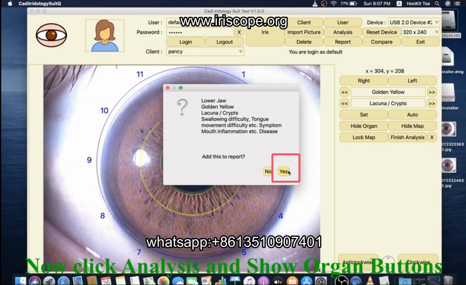 How to use maikong iridology software in apple mac os