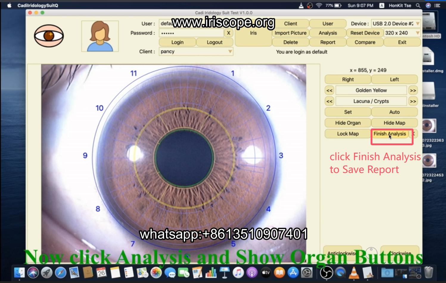 How to use maikong iridology software in apple mac os