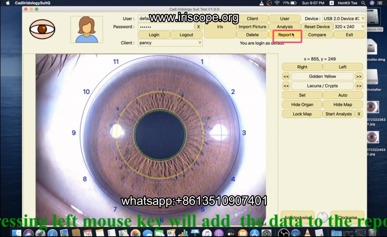 How to use maikong iridology software in apple mac os