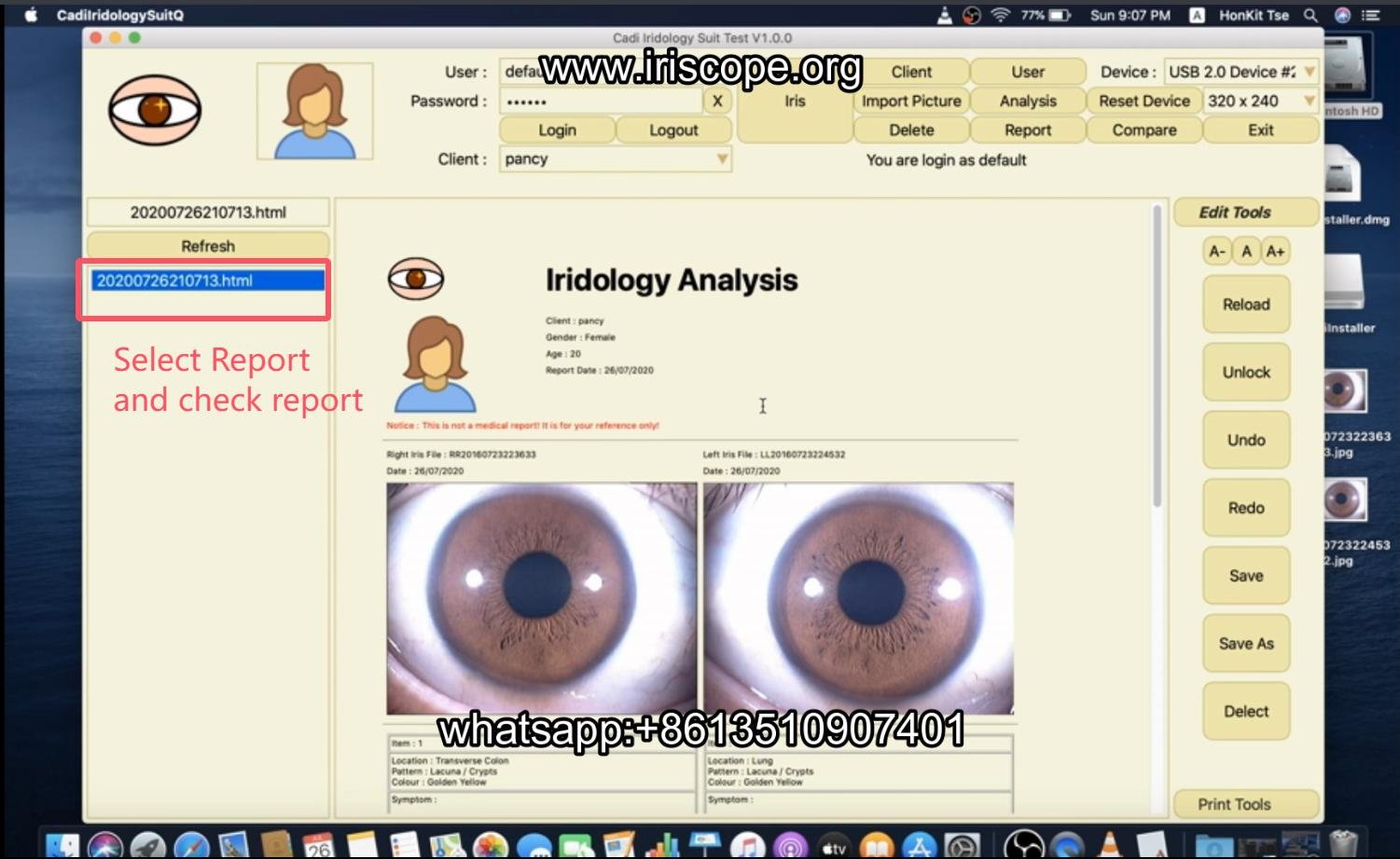 How to use maikong iridology software in apple mac os