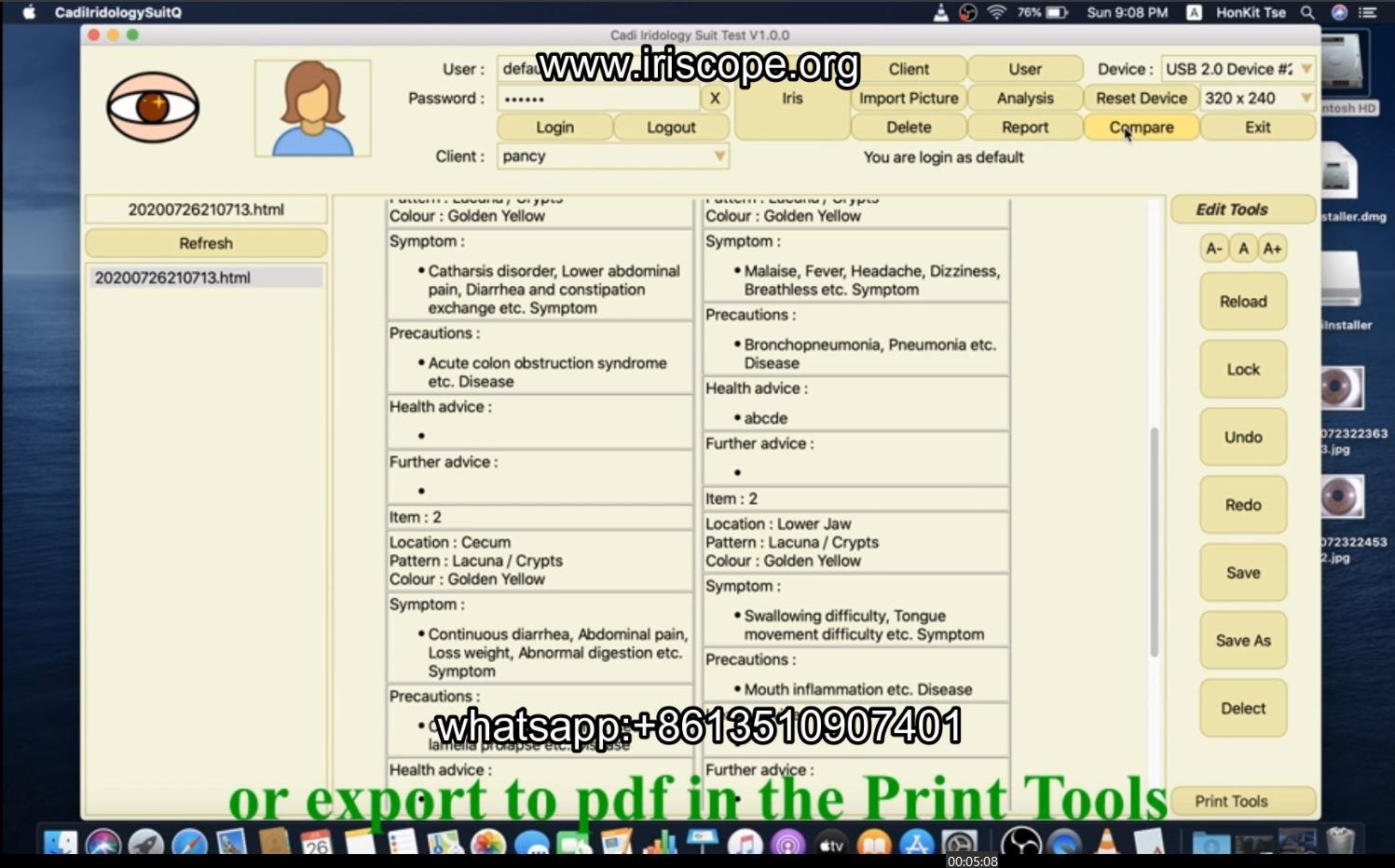 How to use maikong iridology software in apple mac os