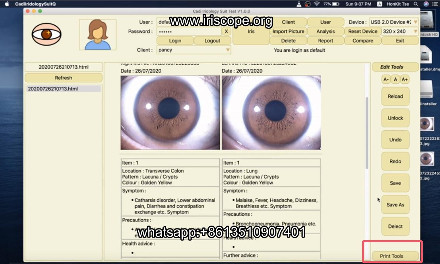 How to use maikong iridology software in apple mac os
