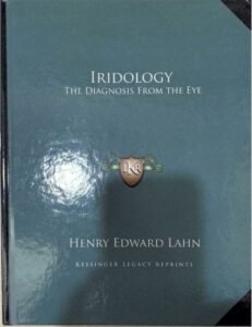 IRIDOLOGY The diagnosis from the eye