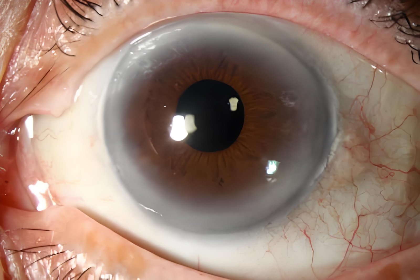 Top 20 Holistic Iridologist Near Me