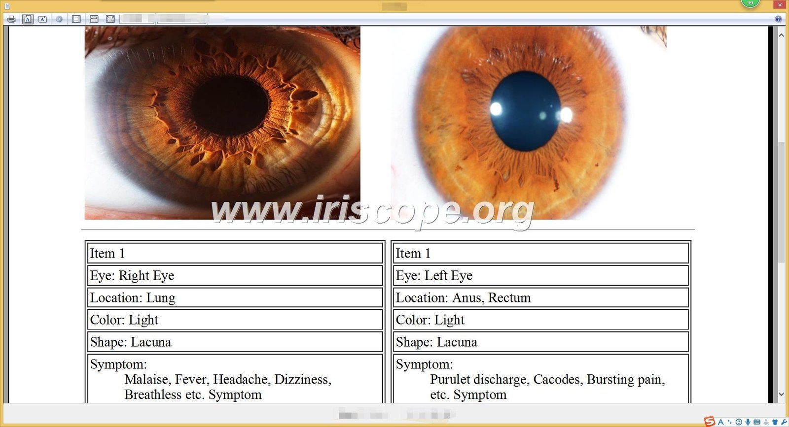 Iridology software for mac 26