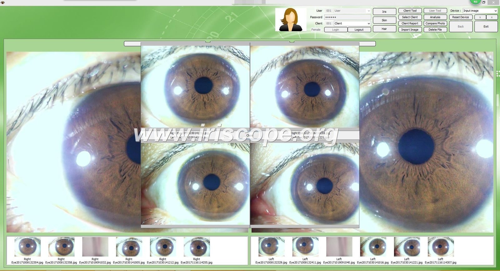 Iridology software for mac 28