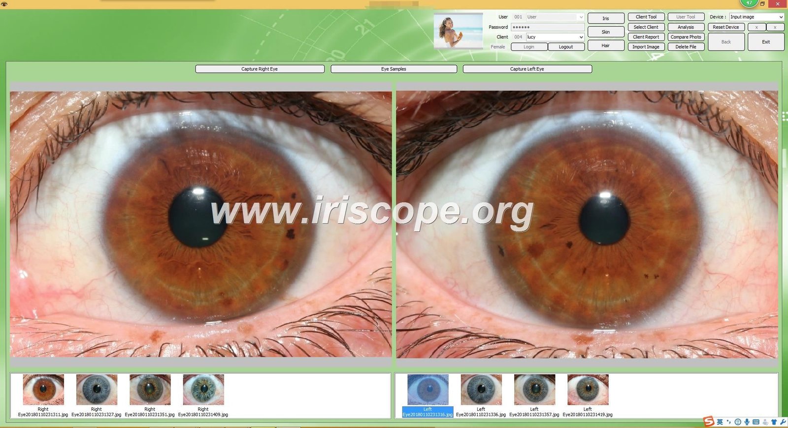 Iridology software for mac 29