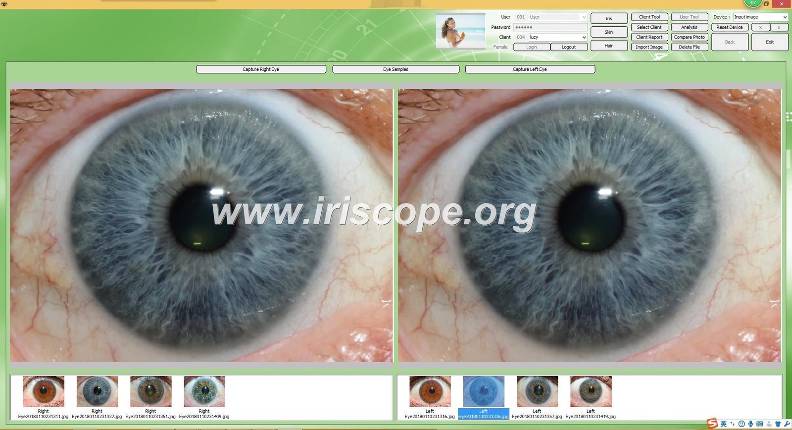 Iridology software for mac 30
