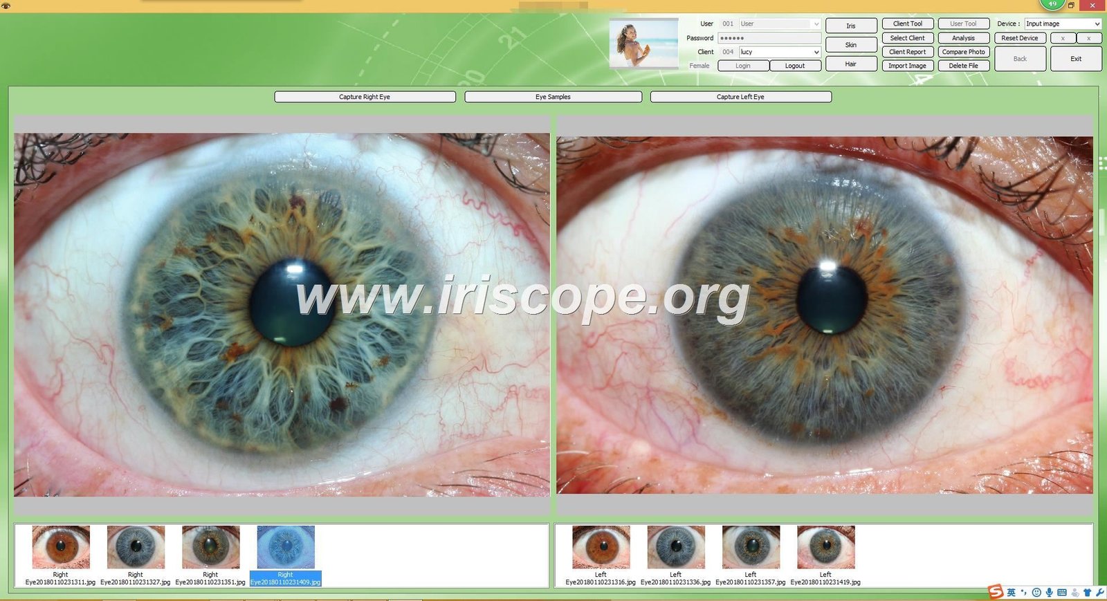 Iridology software for mac 31