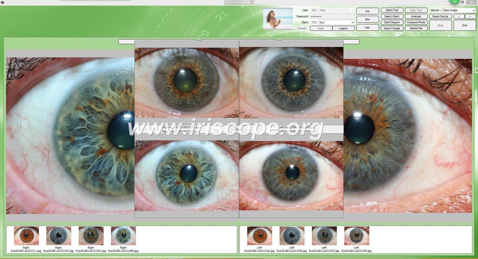 Iridology software