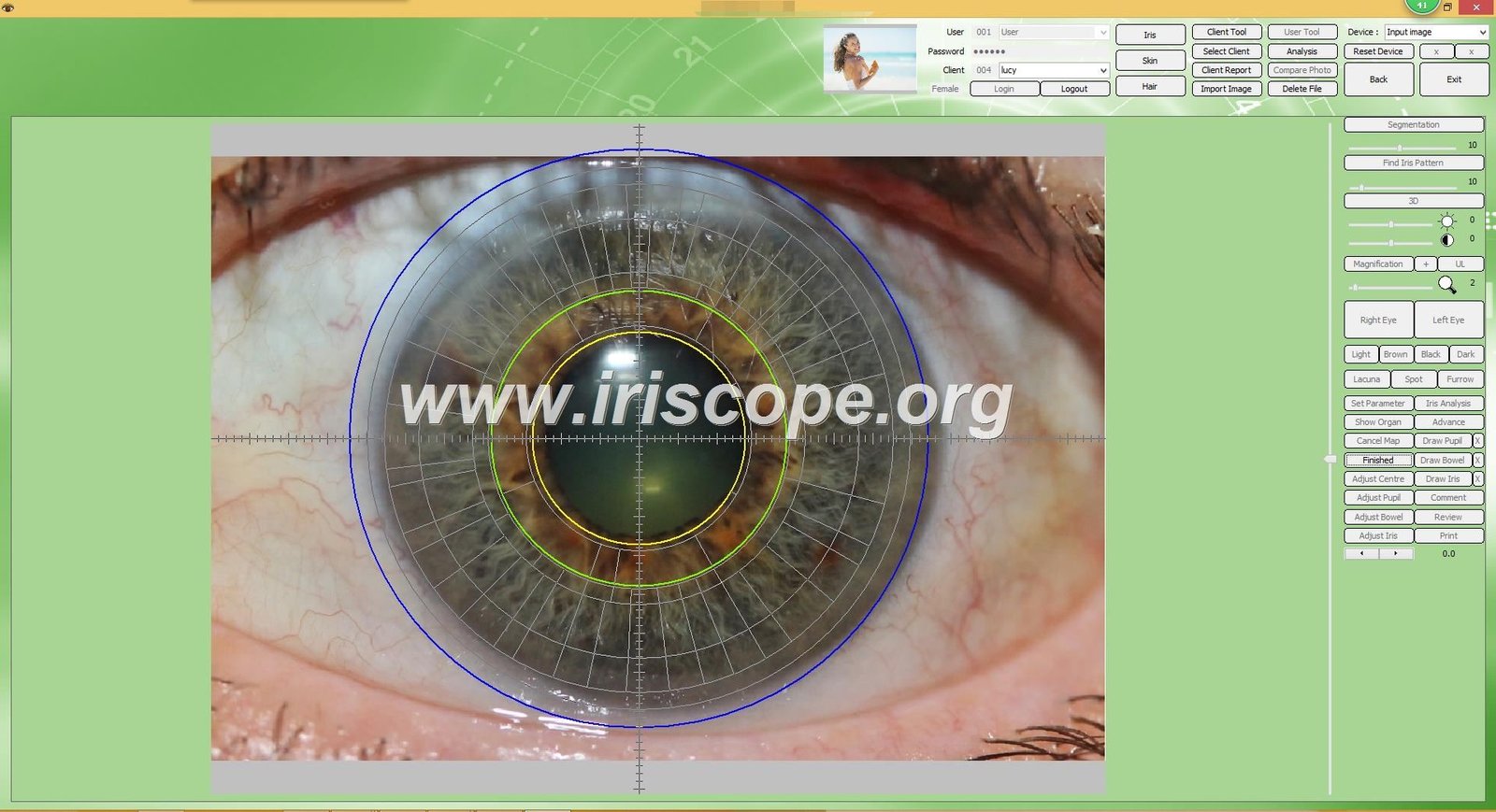Iridology software for mac 34