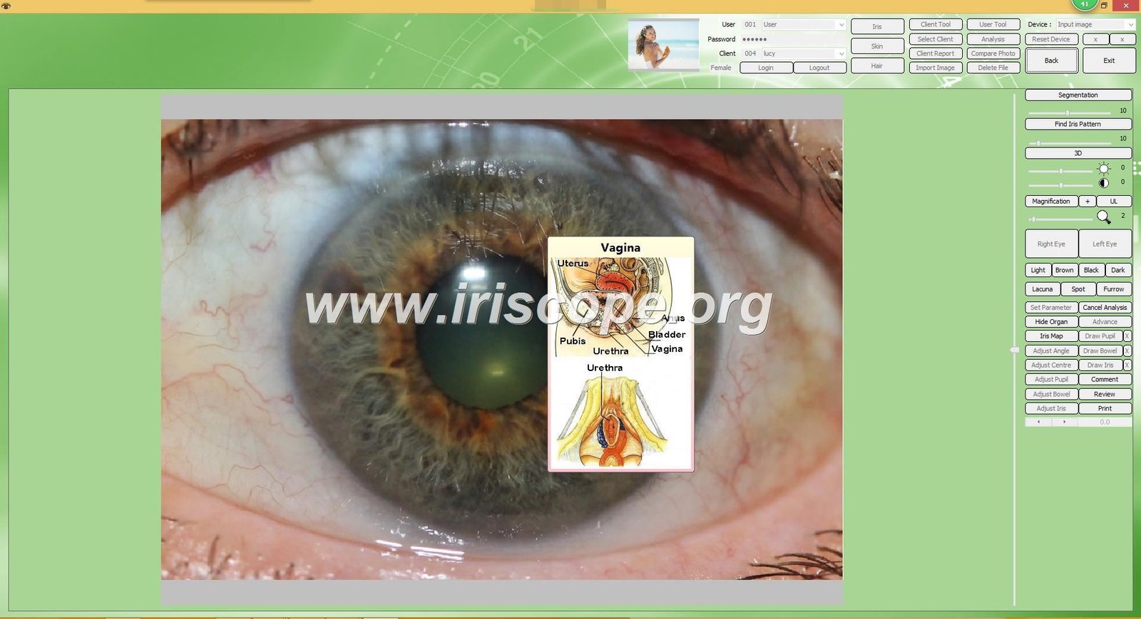 Iridology software for mac 44