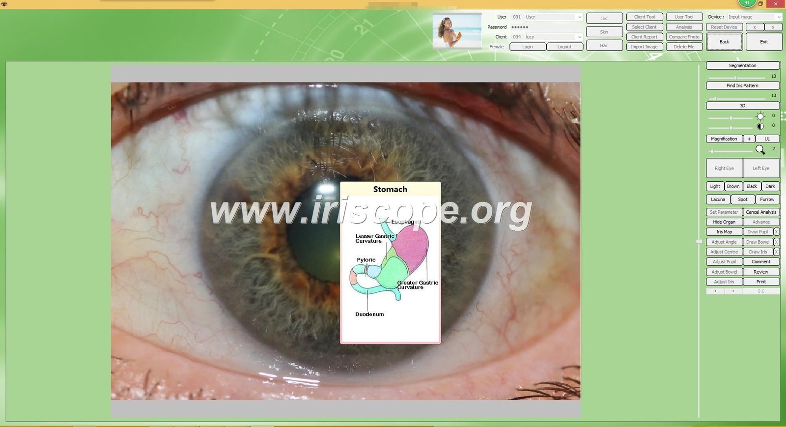 Iridology software for mac 48