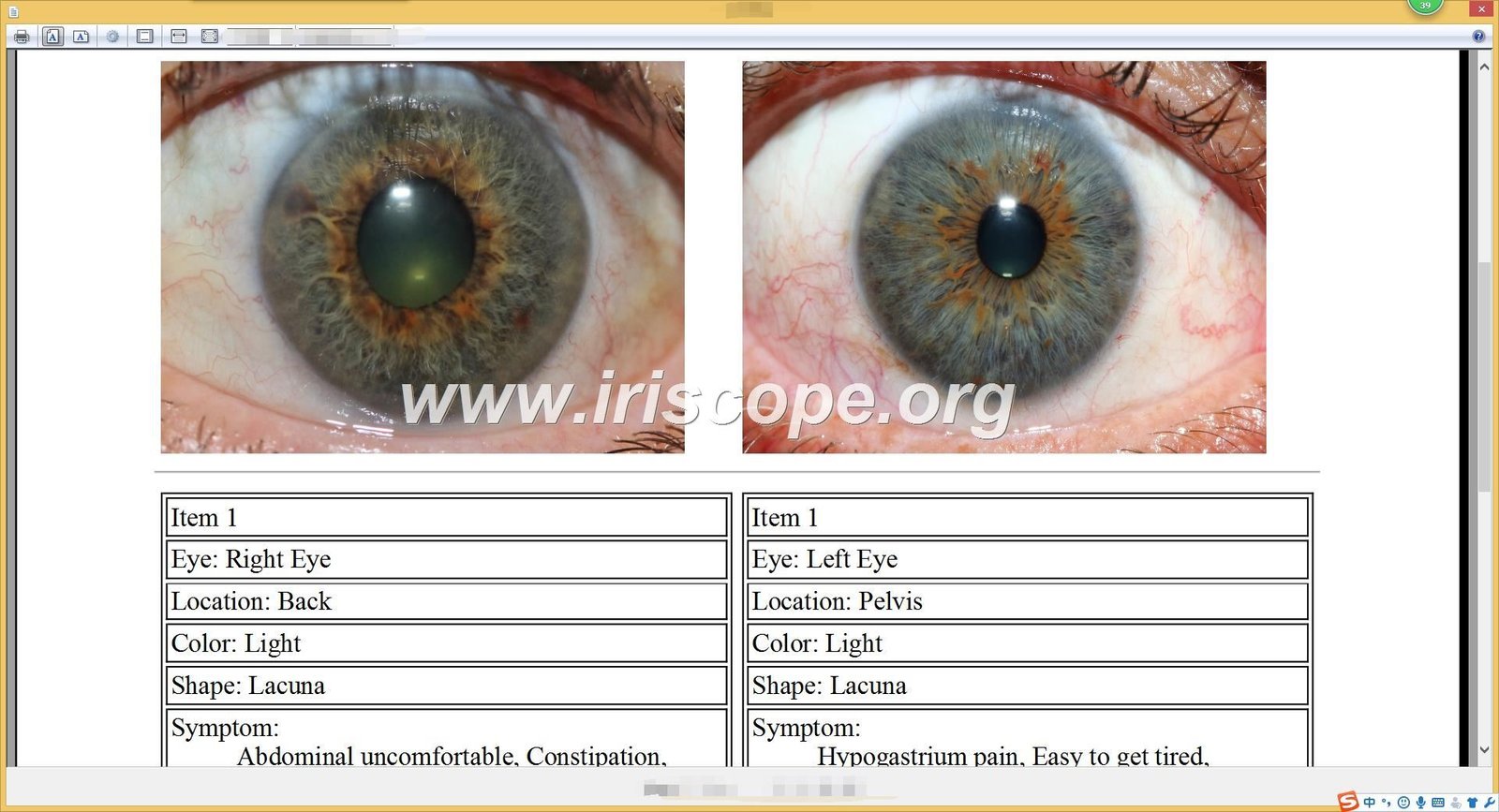 Iridology software for mac 53