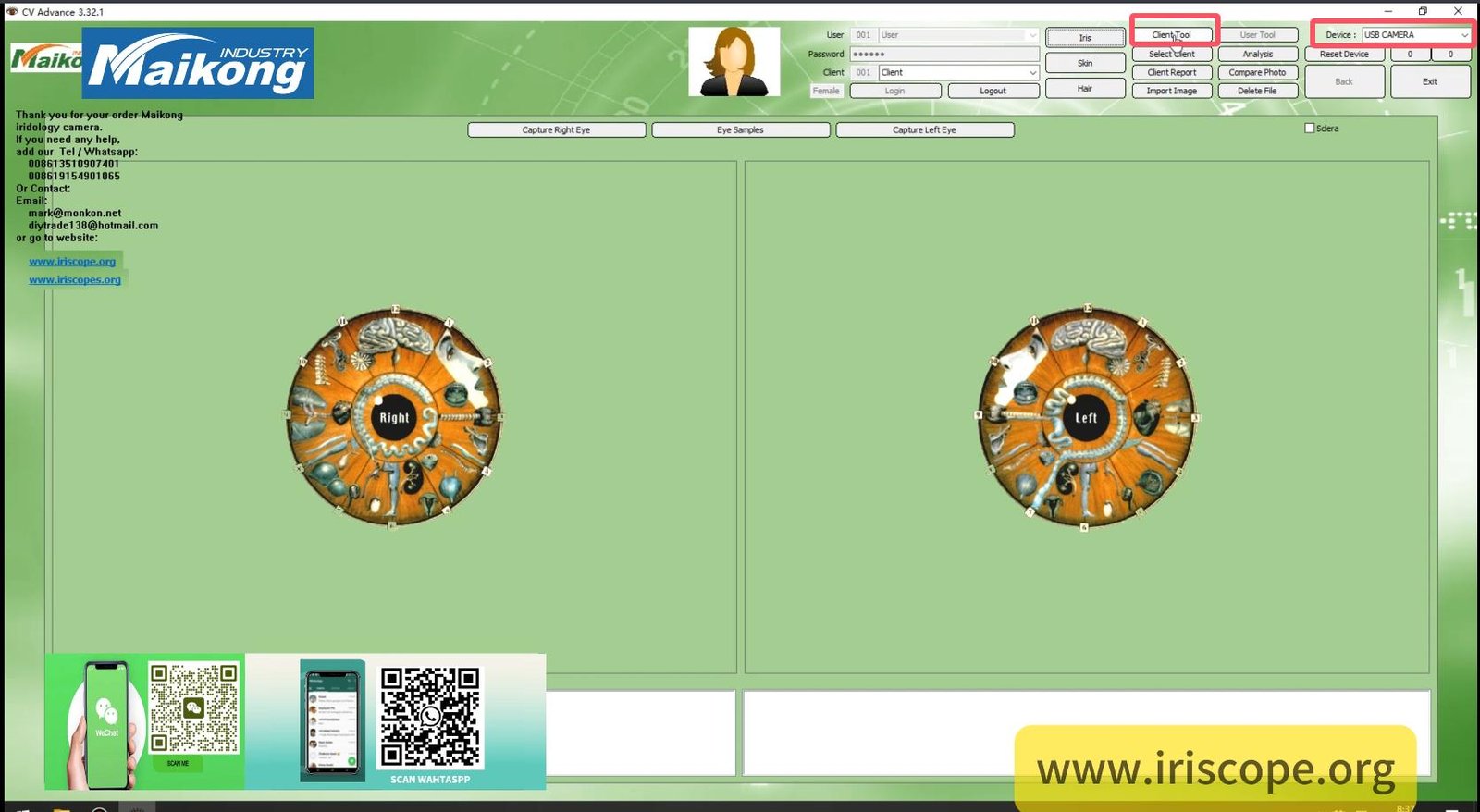 MAIKONG IRIDOLOGY SOFTWARE 2025 English VersionManual Analysis Manaul 005