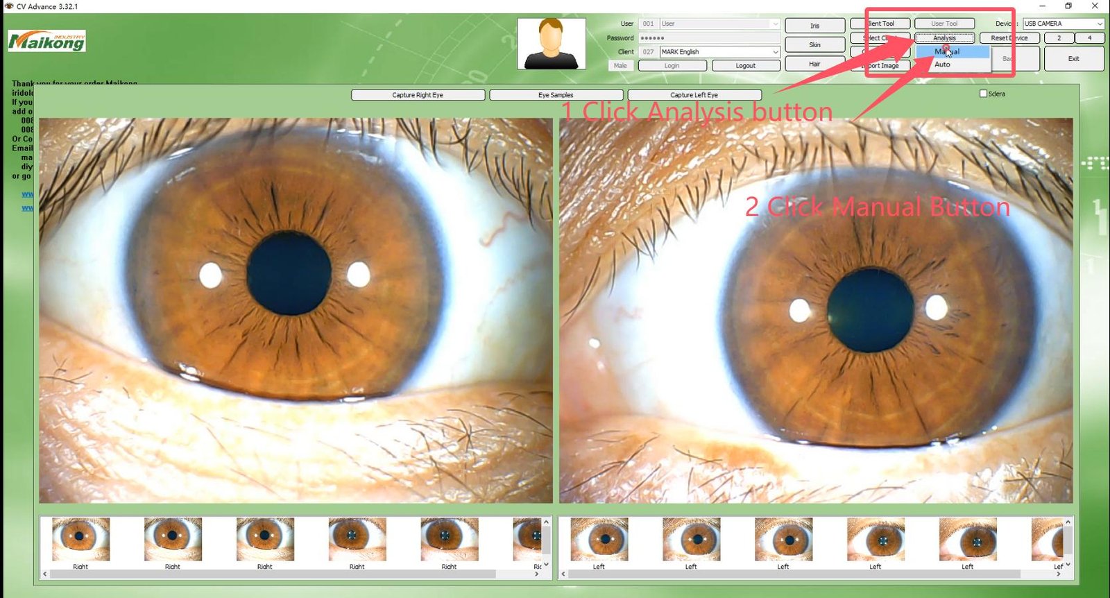 MAIKONG IRIDOLOGY SOFTWARE 2025 English VersionManual Analysis Manaul 012