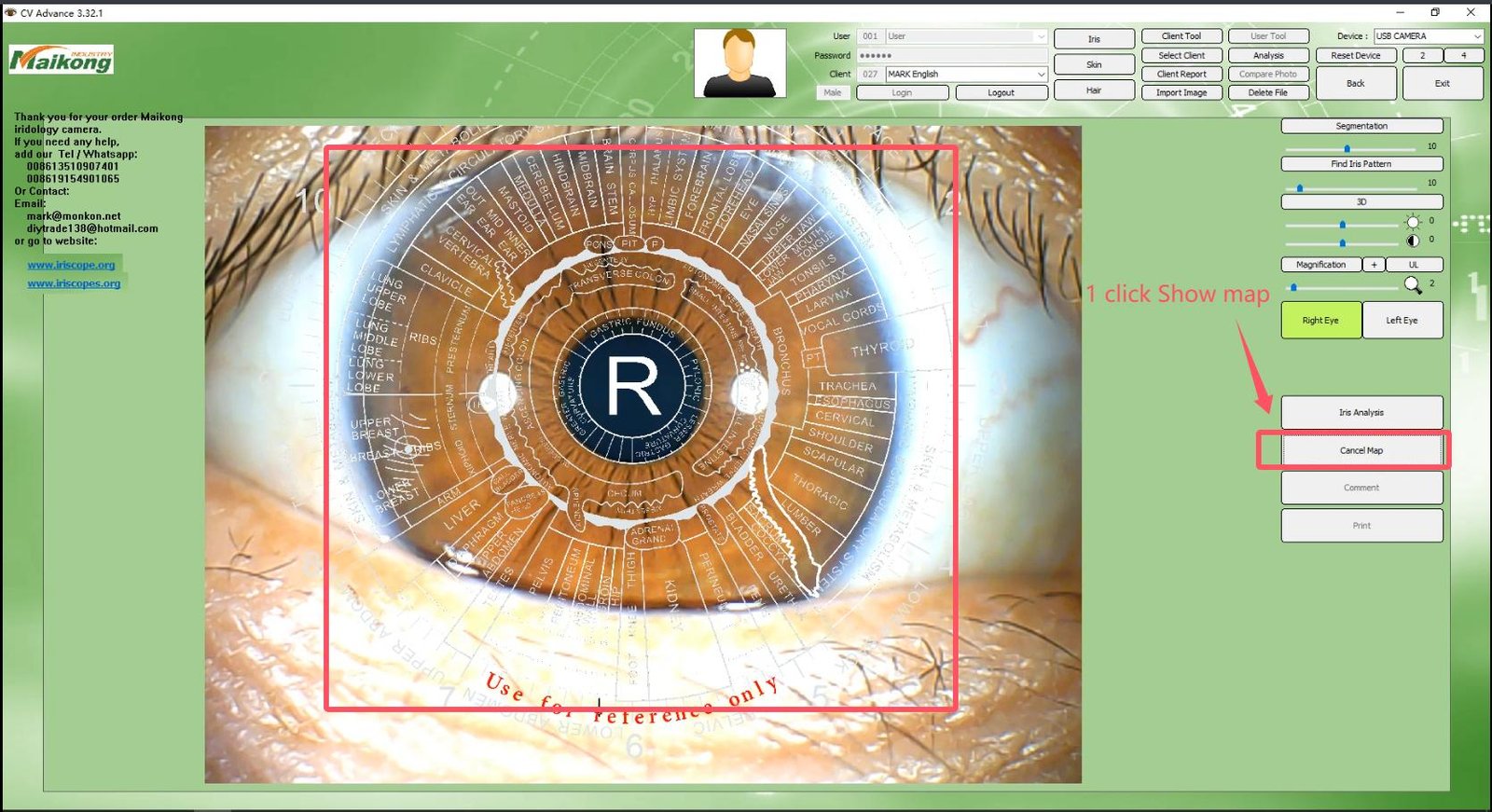 MAIKONG IRIDOLOGY SOFTWARE 2025 English VersionManual Analysis Manaul 013
