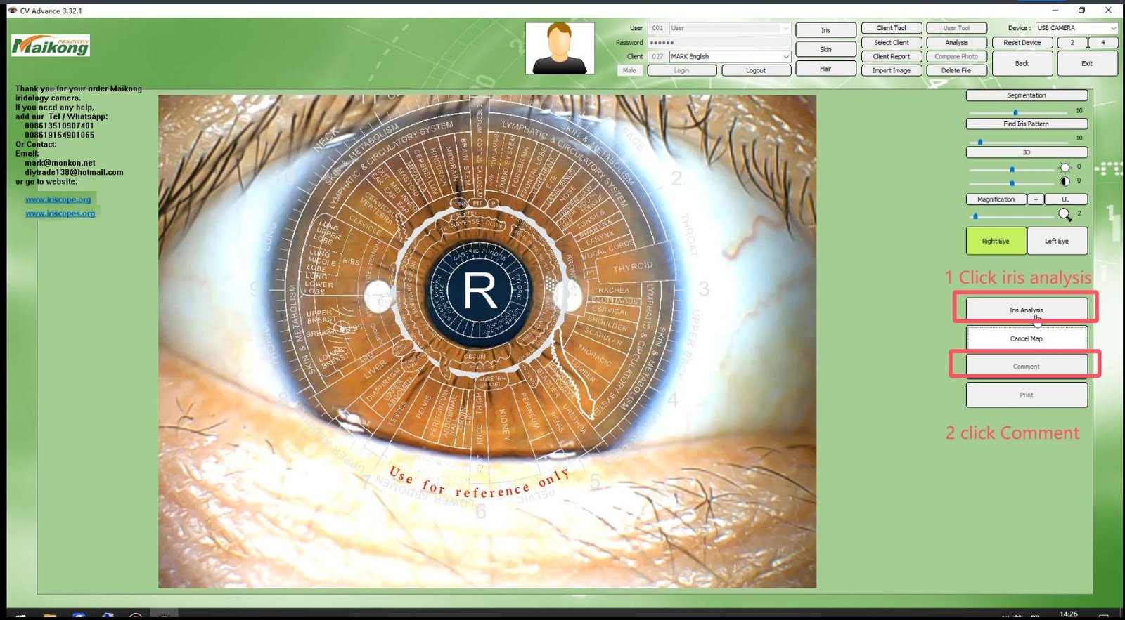 MAIKONG IRIDOLOGY SOFTWARE 2025 English VersionManual Analysis Manaul 014