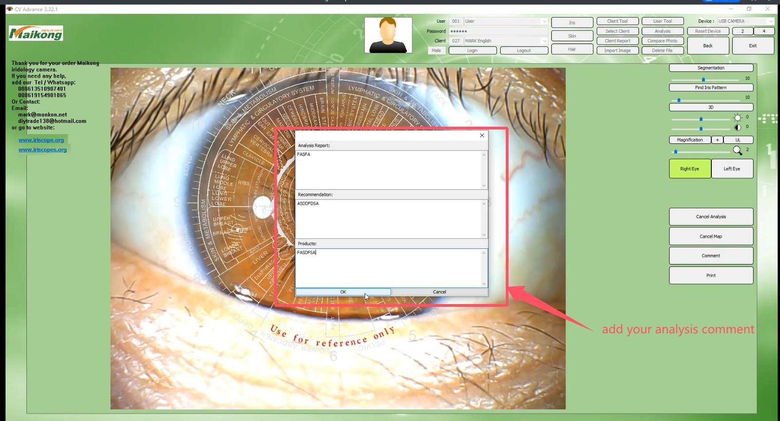 MAIKONG IRIDOLOGY SOFTWARE 2025 English VersionManual Analysis Manaul 015
