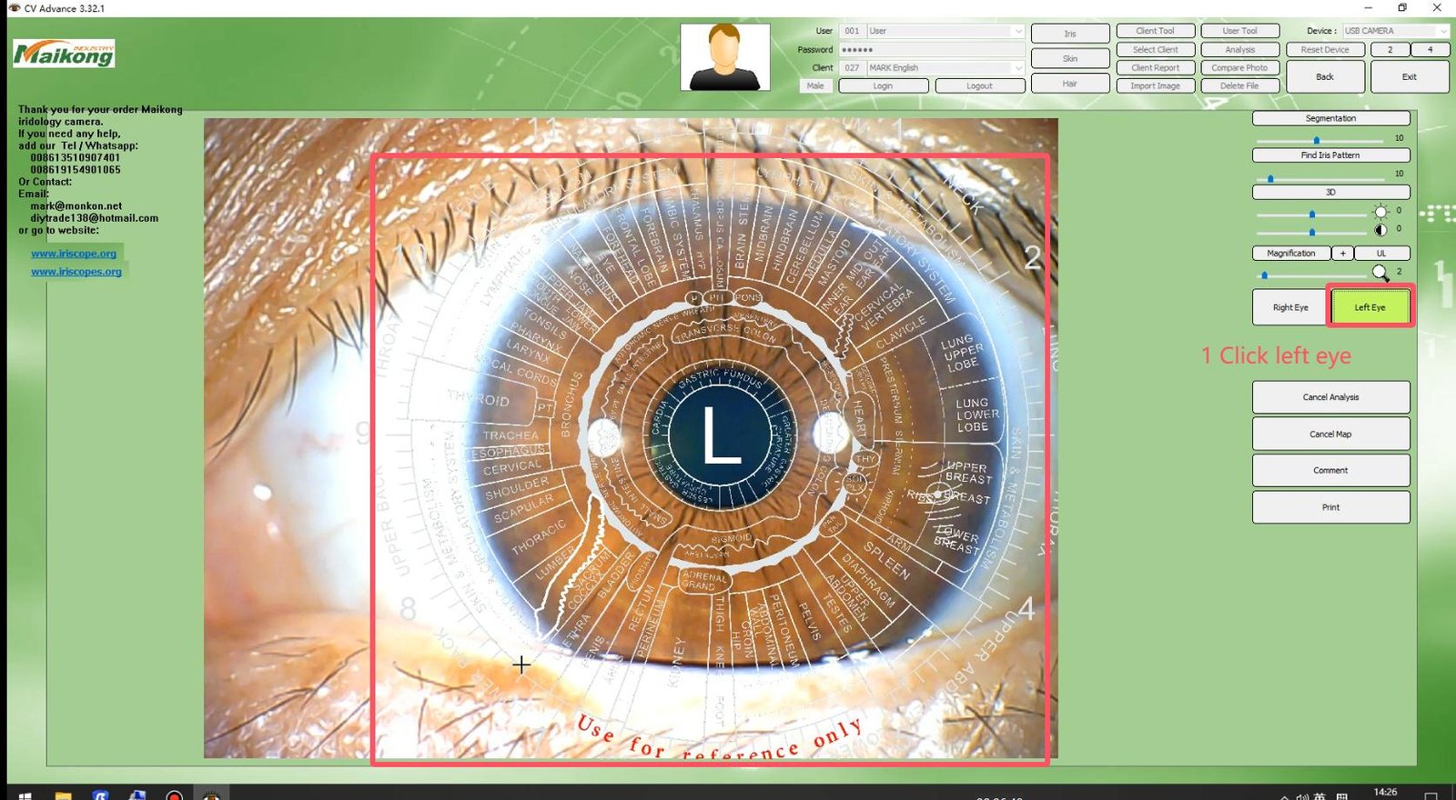 MAIKONG IRIDOLOGY SOFTWARE 2025 English VersionManual Analysis Manaul 016