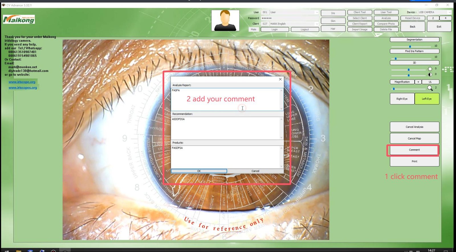 MAIKONG IRIDOLOGY SOFTWARE 2025 English VersionManual Analysis Manaul 017