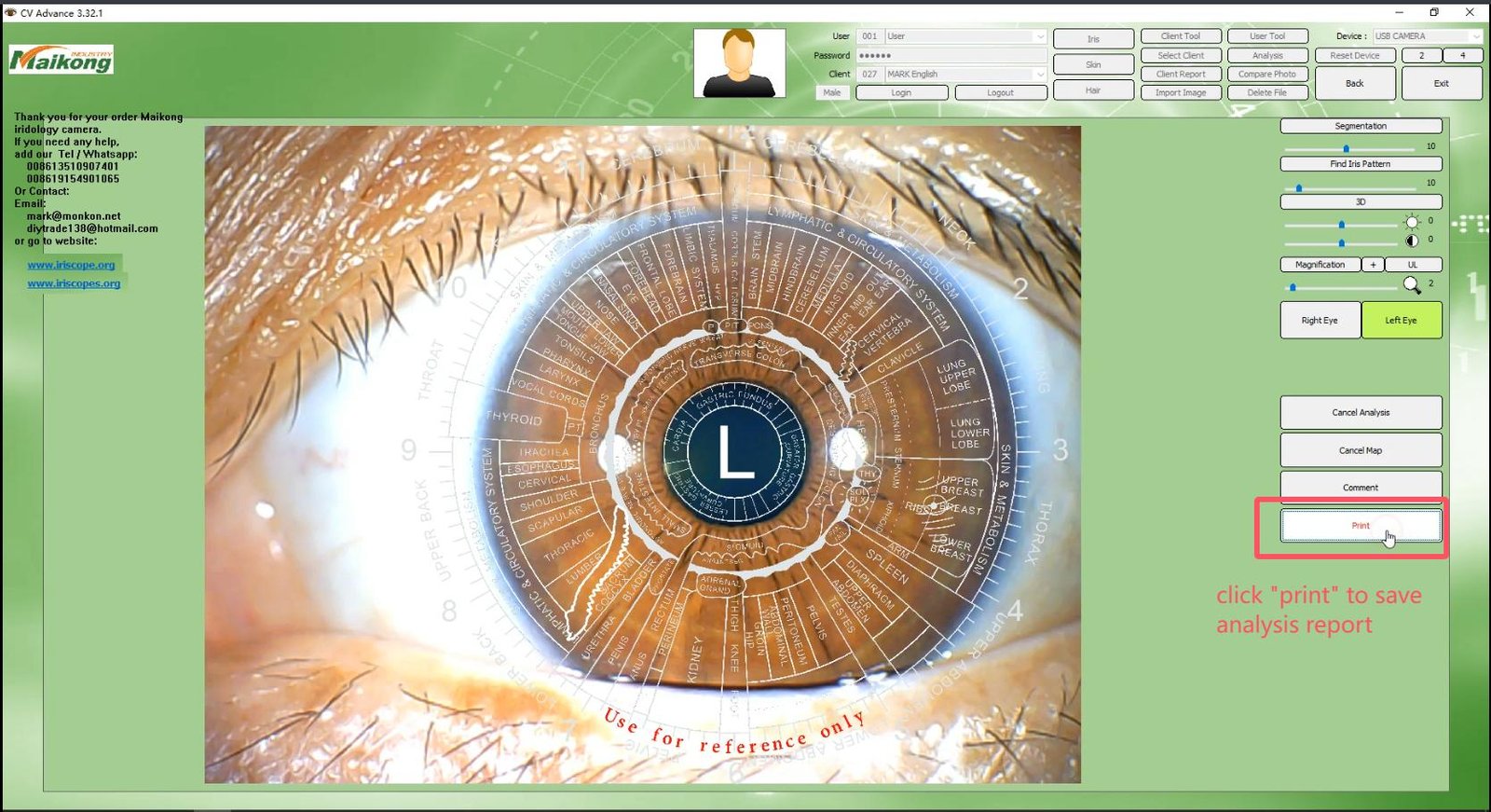 MAIKONG IRIDOLOGY SOFTWARE 2025 English VersionManual Analysis Manaul 018