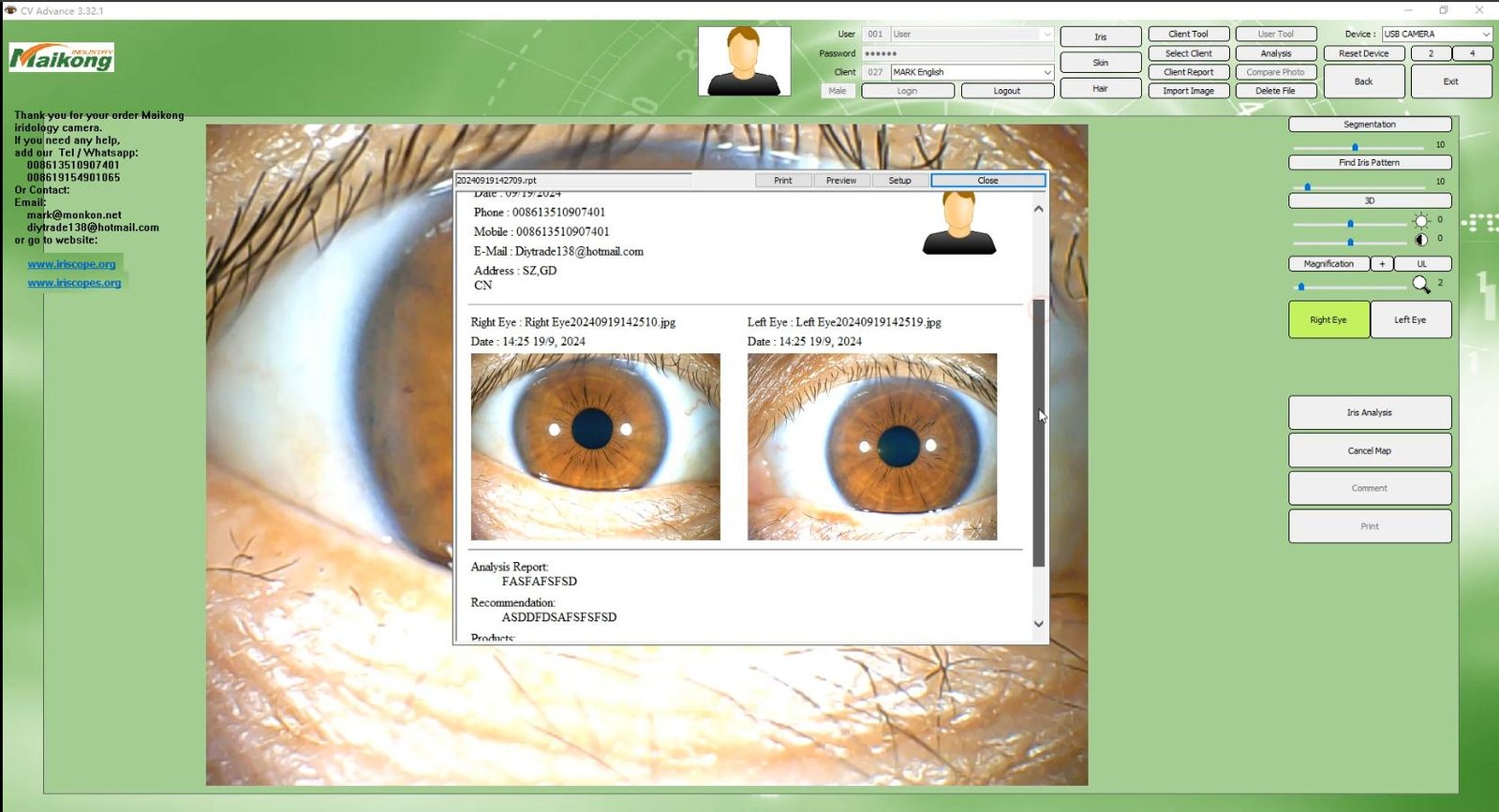 MAIKONG IRIDOLOGY SOFTWARE 2025 English VersionManual Analysis Manaul 019