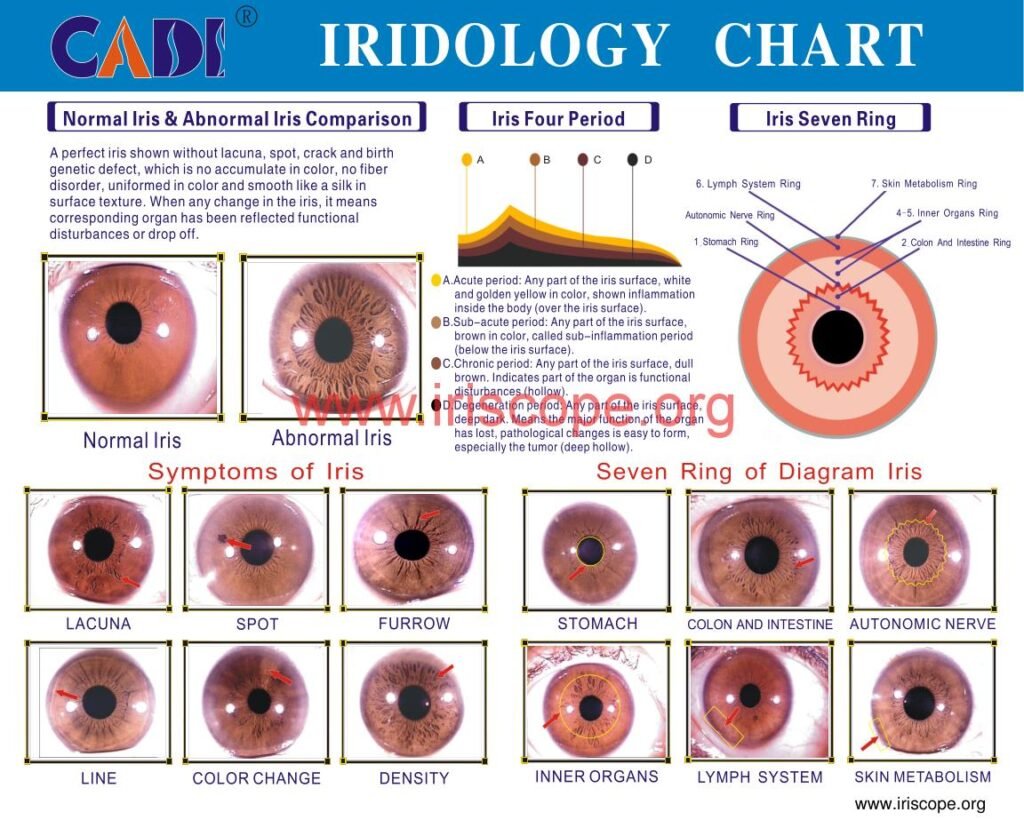 MAIKONG IRIDOLOIGY CHART 5 1