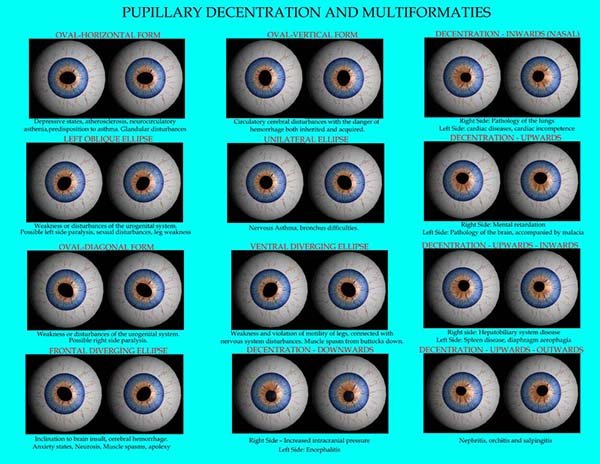 PUPILLARY FLATTENINGS CHART2