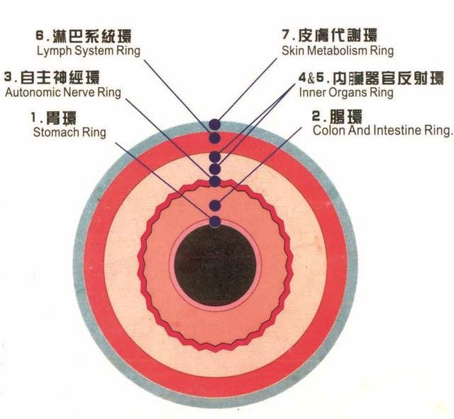 Seven Ring Iridology and Health Implications