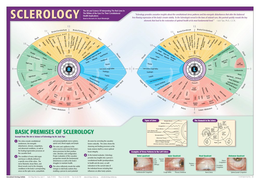 sclerology Iridology Chart