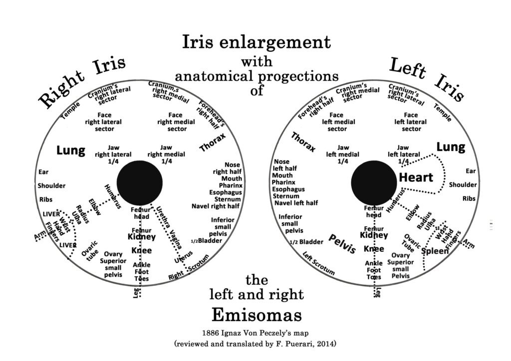 the left and right Emisomas