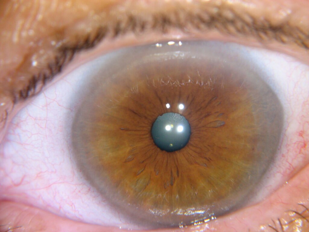 MAIKONG IRIDOLOGY CAMERA 1467