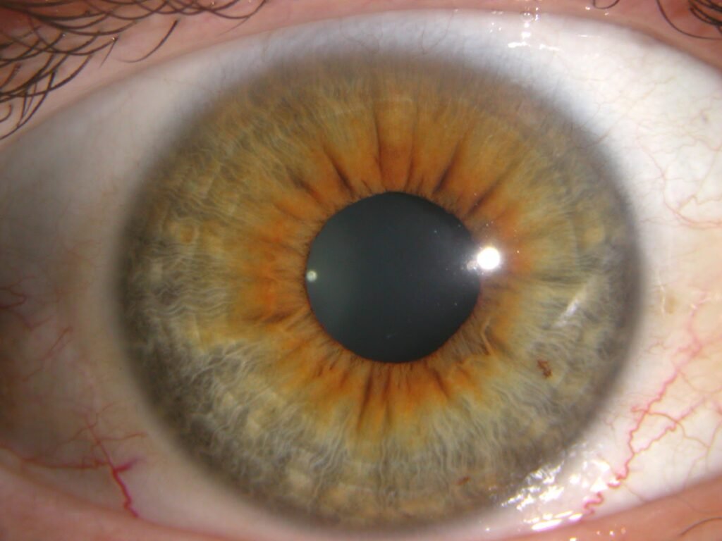 MAIKONG IRIDOLOGY CAMERA 1522