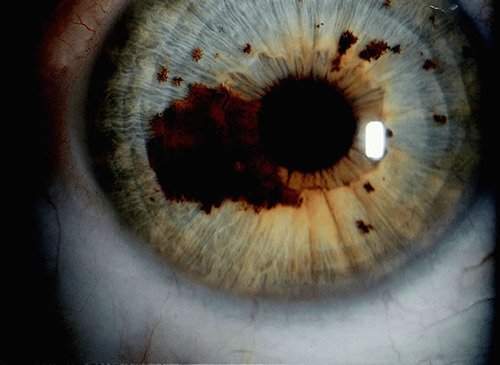 MAIKONG IRIDOLOGY CAMERA 1523