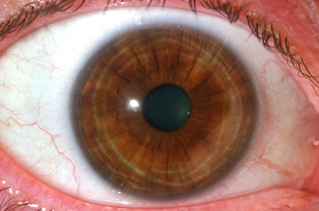 MAIKONG IRIDOLOGY CAMERA 1590