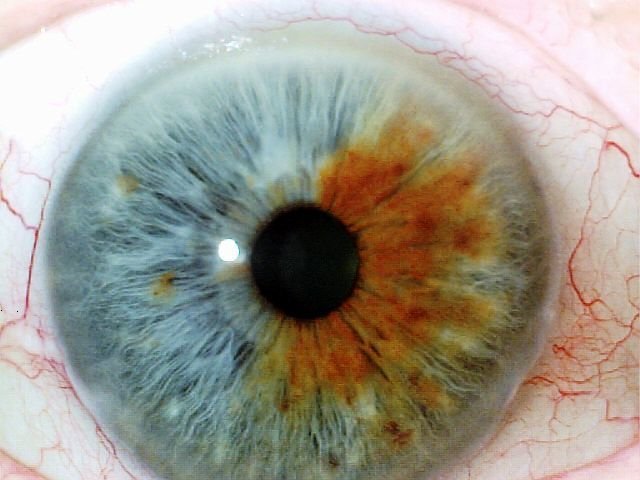 MAIKONG IRIDOLOGY CAMERA 1591