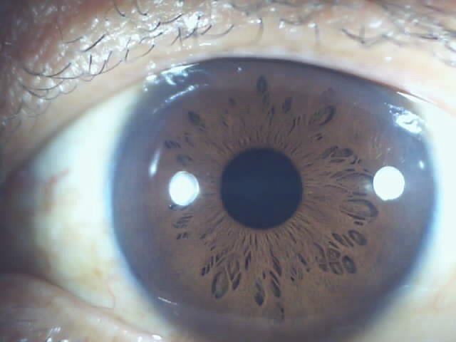 Chapter 2.3: The Color of the Iris