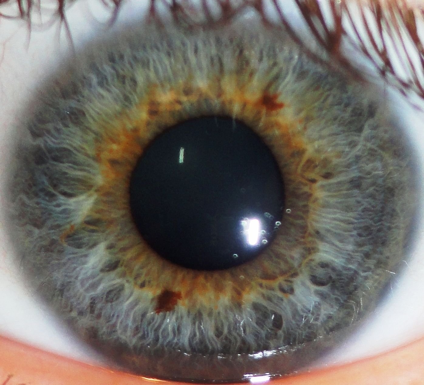 Chapter 2.4: The Relationship Between the Pupil and the Iris