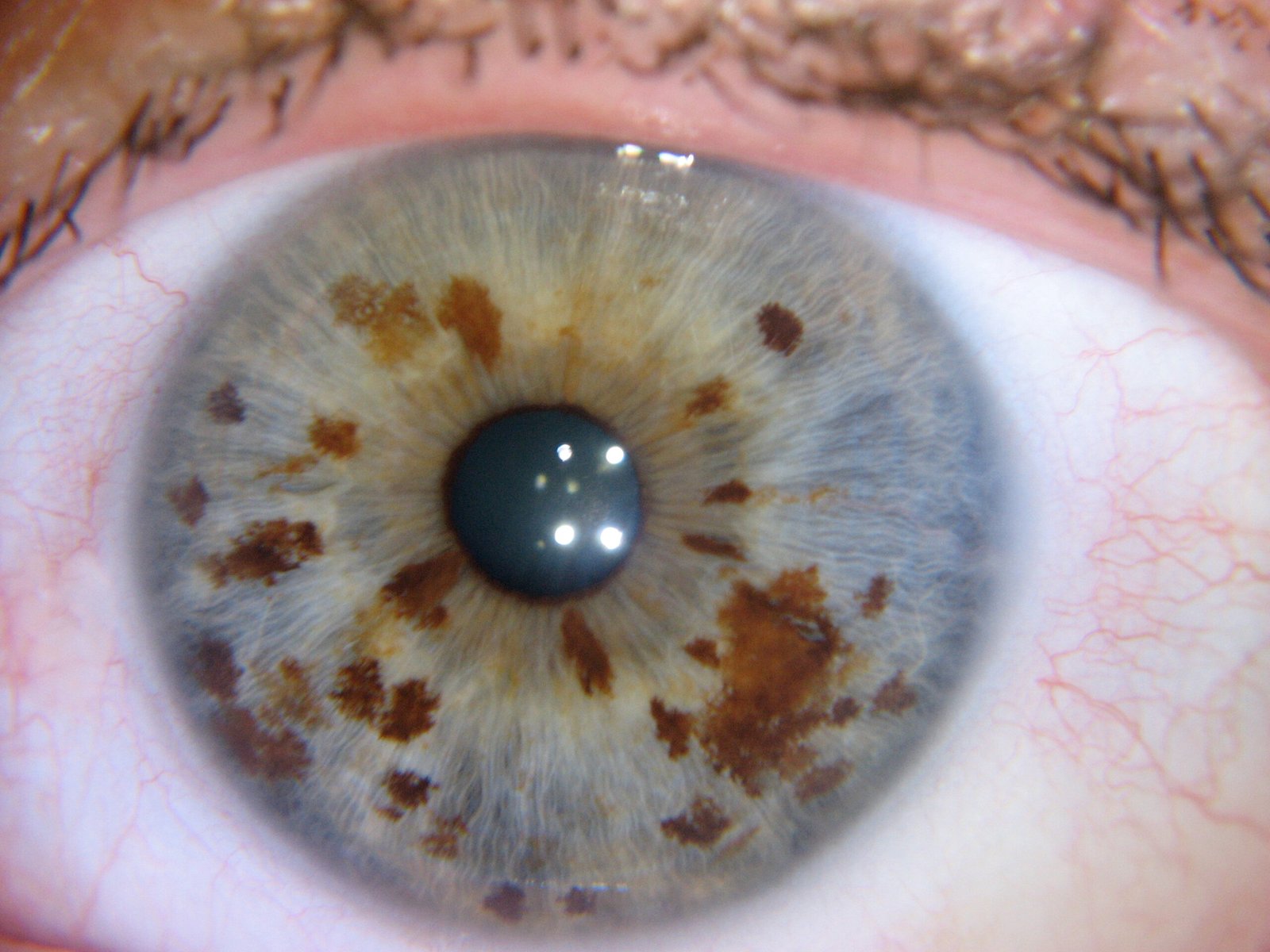 Chapter 2.4: The Relationship Between the Pupil and the Iris